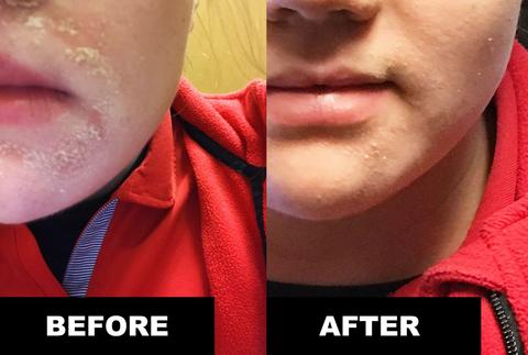 One Application - Next Day RESULTS